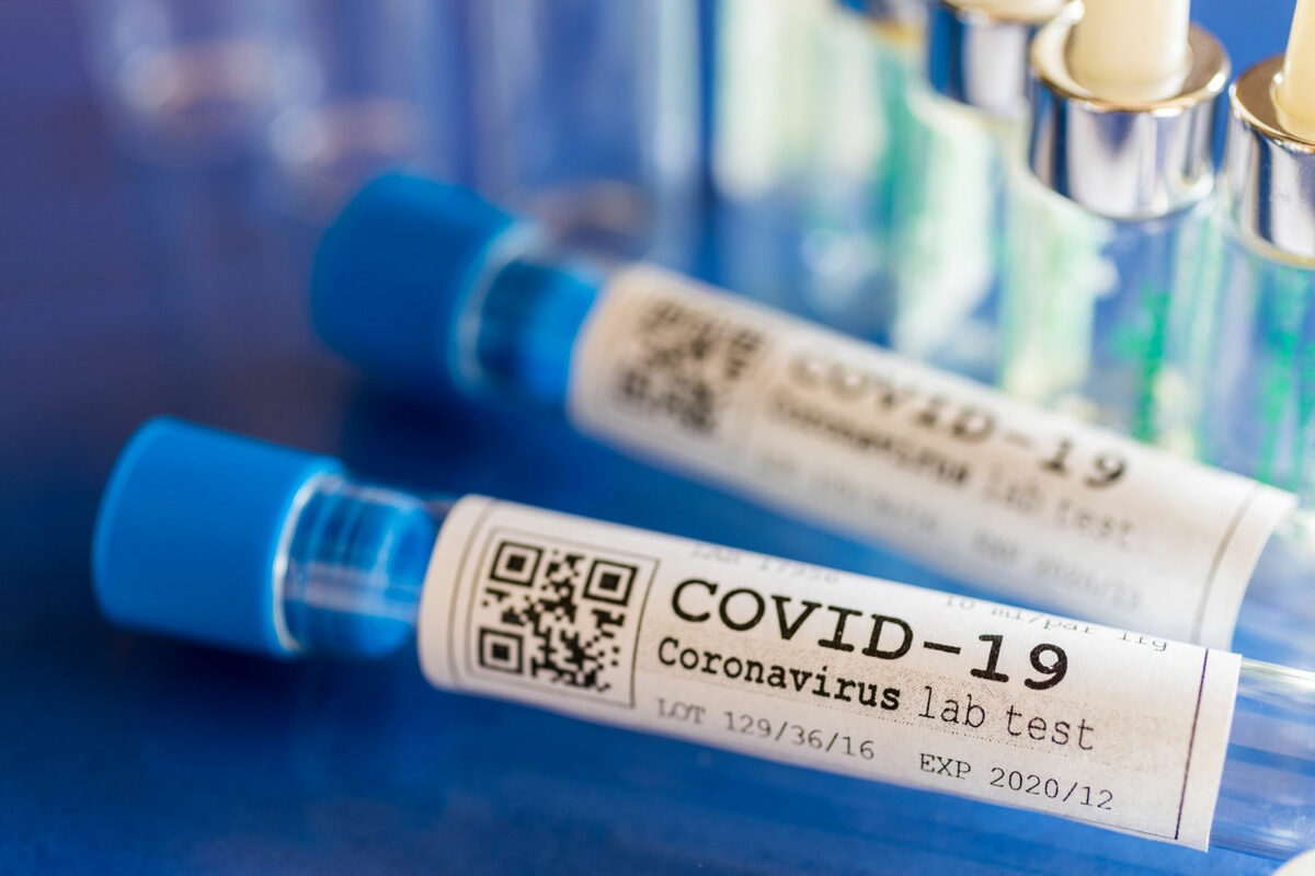 Covid 19 Lab test tube